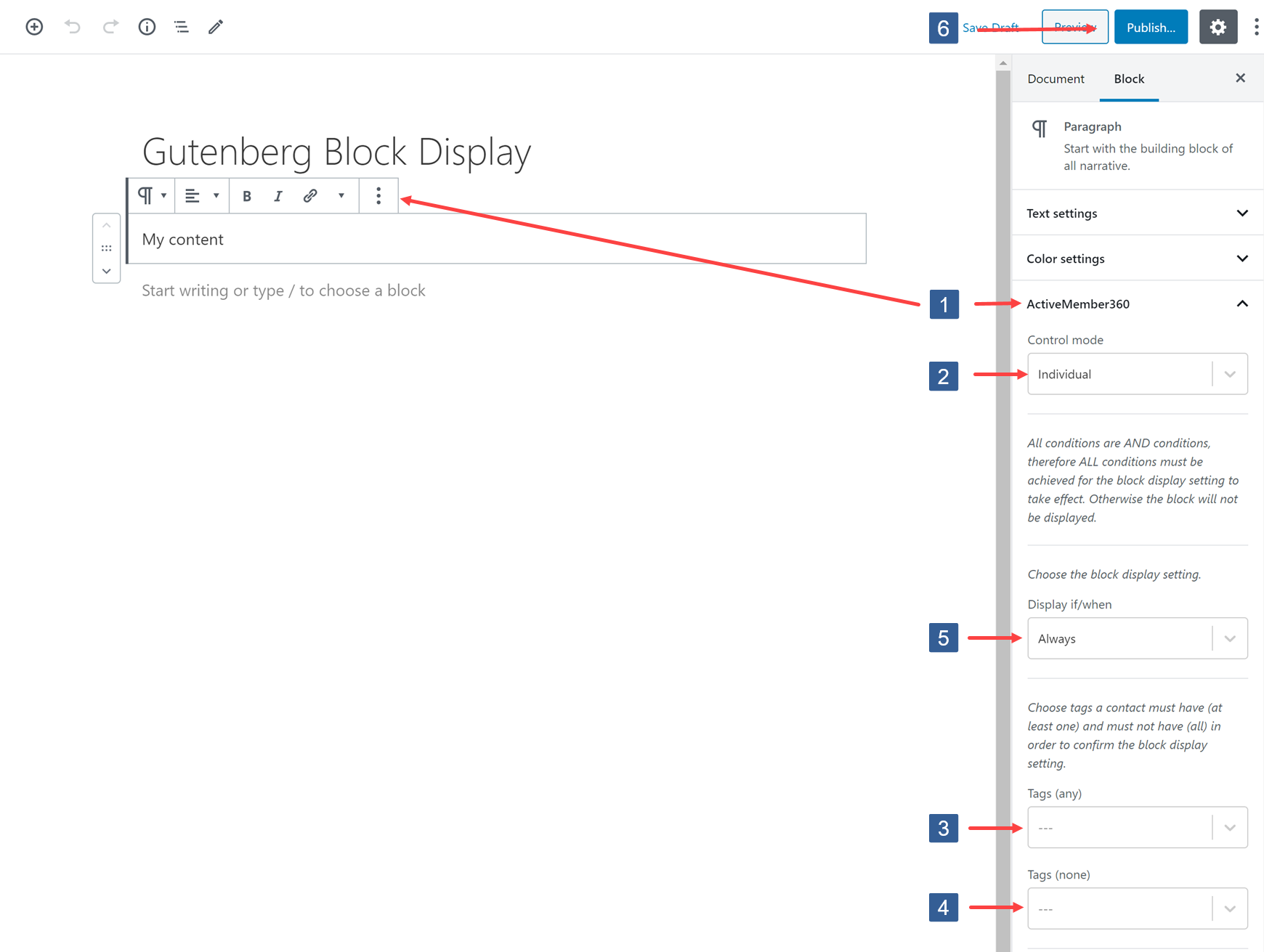 Steps for specifying display conditions for Block Editor block based upon contact tags